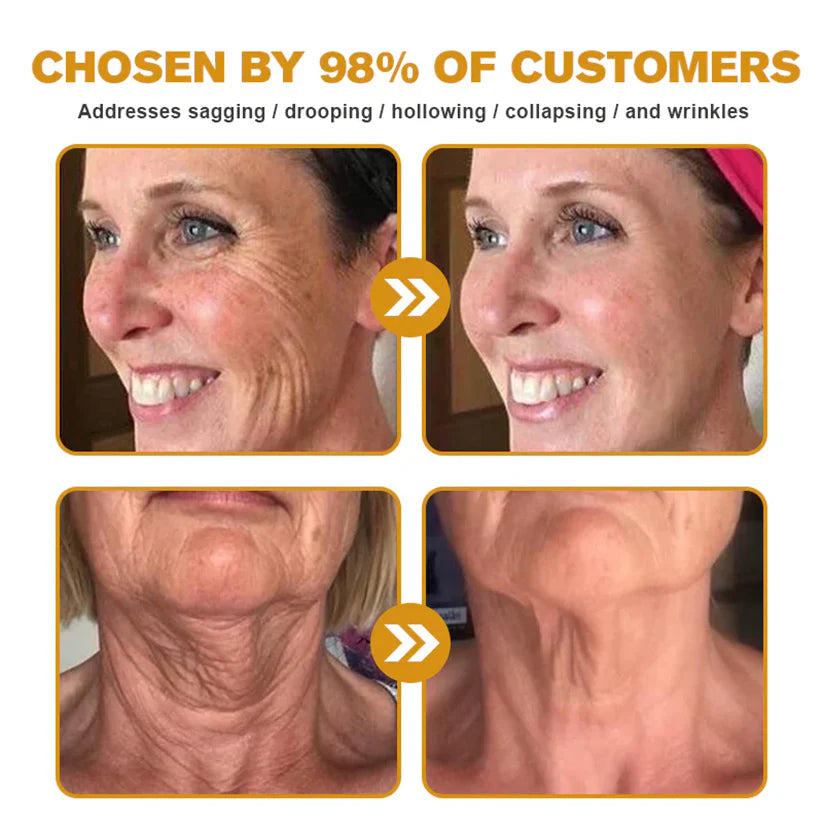 🐝🐝FDA Approved: LOVILDS® Bee venom Pro Comprehensive Cream — 🔥Limited Time 80% OFF🔥