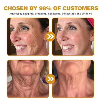 🐝🐝FDA Approved: LOVILDS® Bee venom Pro Comprehensive Cream — 🔥Limited Time 80% OFF🔥
