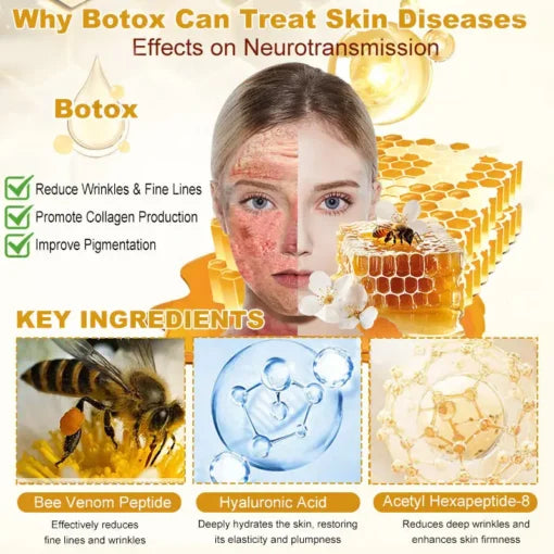 🐝🐝FDA Approved: LOVILDS® Bee venom Pro Comprehensive Cream — 🔥Limited Time 80% OFF🔥