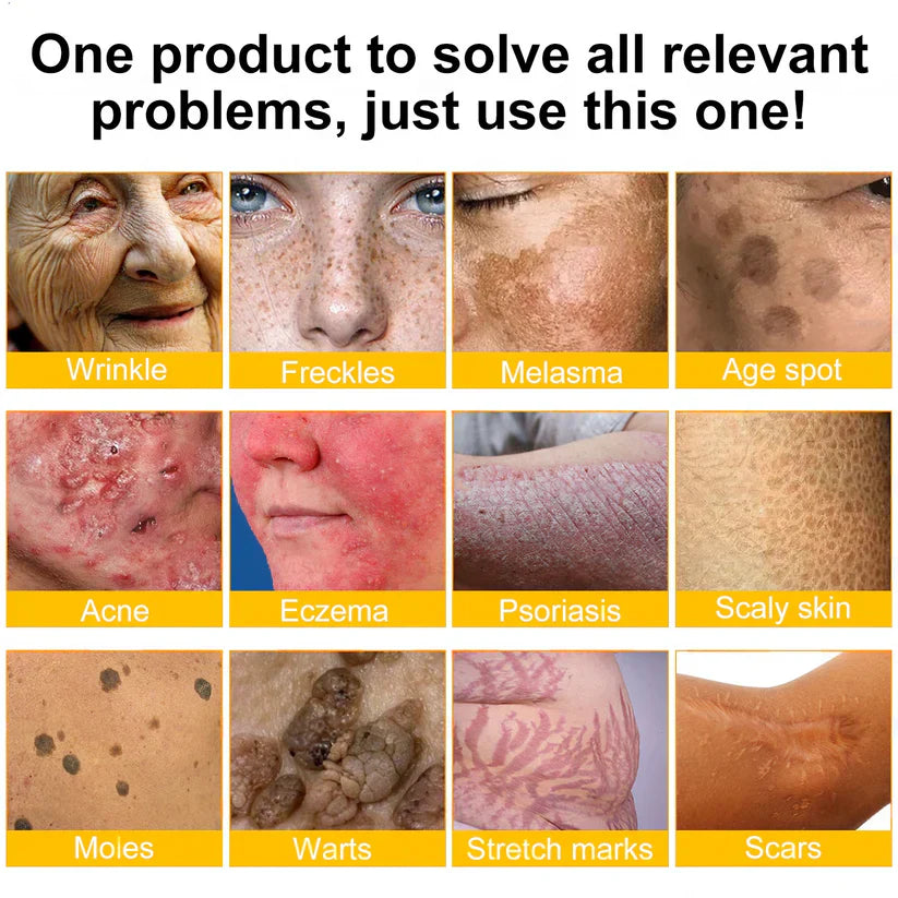 🐝🐝FDA Approved: LOVILDS® Bee venom Pro Comprehensive Cream — 🔥Limited Time 80% OFF🔥