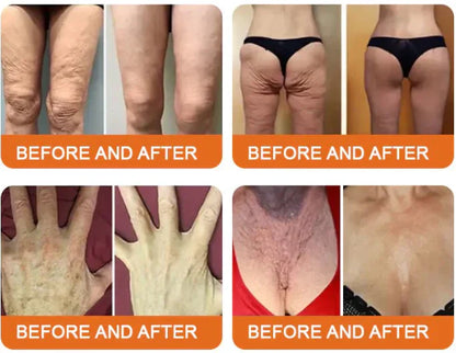 🐝🐝FDA Approved: LOVILDS® Bee venom Pro Comprehensive Cream — 🔥Limited Time 80% OFF🔥